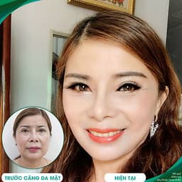 Thẩm Mỹ Ruby Beauty - Bác Sĩ Lương Ngọc|Lưu Giữ Thanh Xuân Với Dịch Vụ Căng Da Trẻ Hóa Và Tạo Má Lúm Đồng Tiền