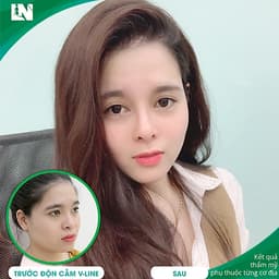 Thẩm Mỹ Ruby Beauty - Bác Sĩ Lương Ngọc|Gương Mặt Thanh Thoát Nhờ Cằm V-Line