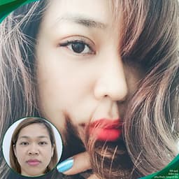 Thẩm Mỹ Ruby Beauty - Bác Sĩ Lương Ngọc|Mũi Đẹp Tự Nhiên - Cải Thiện Vận Số