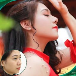Thẩm Mỹ Ruby Beauty - Bác Sĩ Lương Ngọc|Mũi Đẹp Tự Nhiên - Cải Thiện Vận Số