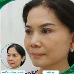 Thẩm Mỹ Ruby Beauty - Bác Sĩ Lương Ngọc|Lưu Giữ Thanh Xuân Với Dịch Vụ Căng Da Trẻ Hóa Và Tạo Má Lúm Đồng Tiền