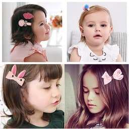 Kẹp tóc cho bé 18 chi tiết hàn quốc (kèm hộp đựng cute)