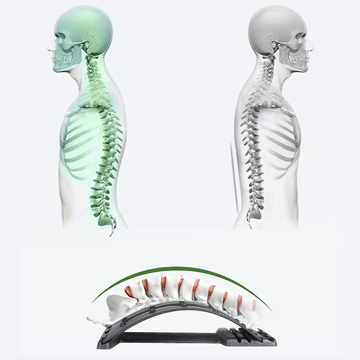 Khung Nắn Chỉnh Cột Sống, Khung Định Hình Cột Sống, Điều Trị Thoát Vị Đĩa Đệm, Đau Lưng, Vai Gáy, Dụng Cụ Hỗ Trợ Tập Lưng - Chính Hãng miDoctor