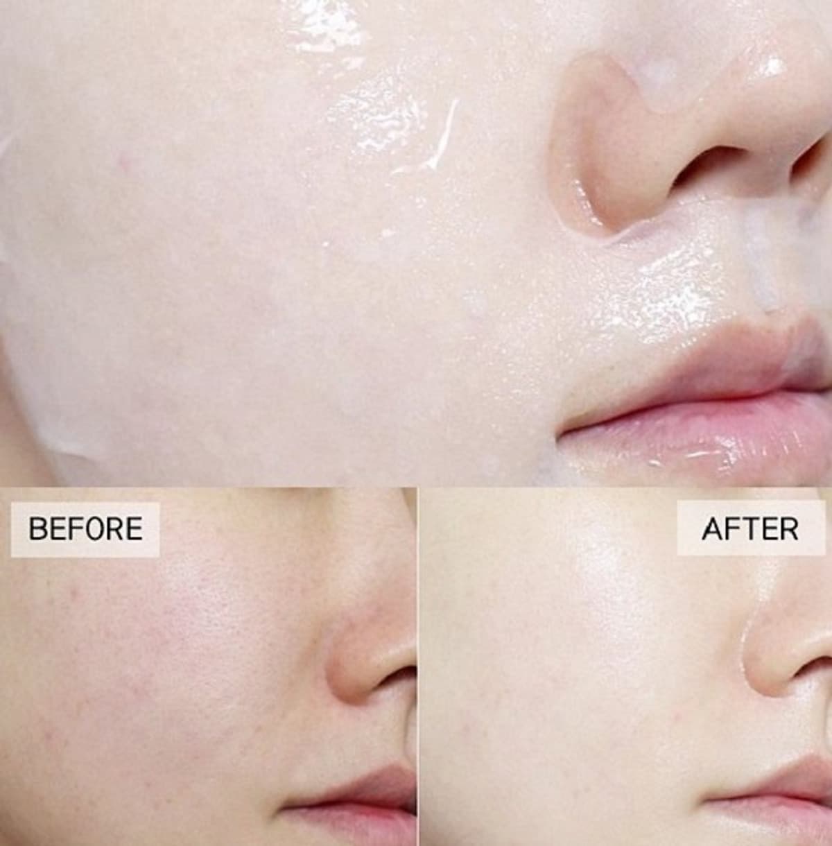 Combo 10 Mặt nạ BNBG Vita Genic Jelly Mask 30ml x10 (Lifting, Whitening, Relaxing, Hydrating)