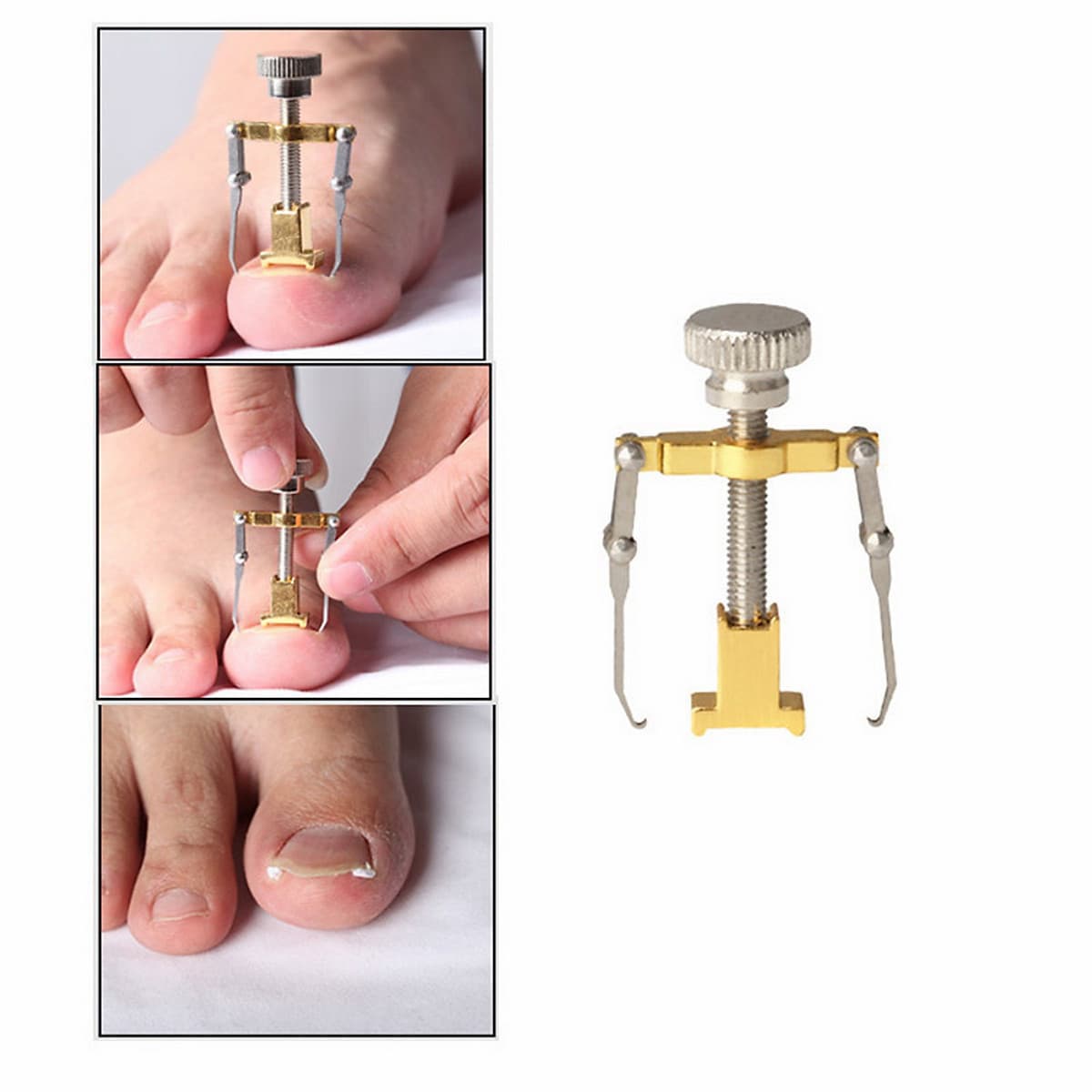Dụng Cụ Bẻ Móng Quặp Thịt