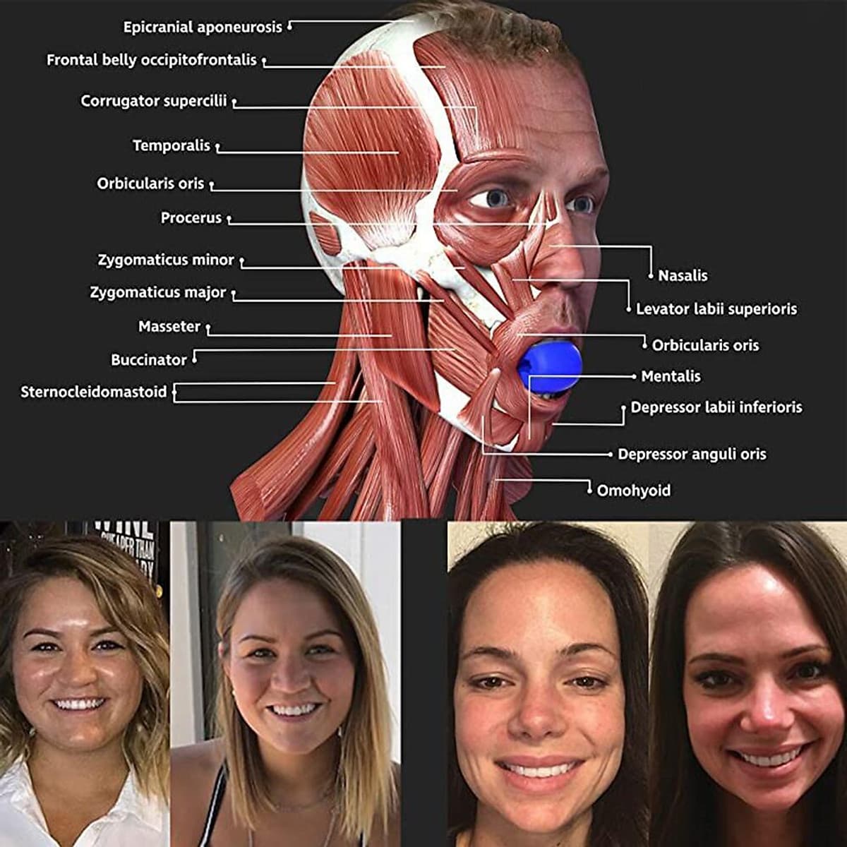 Jaw Exerciser Facial Jaw Toner Define Jawline Neck Exercise Ball Jaw Neck Toning Fitness Ball for Face Lift Double Chin