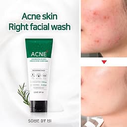 Sữa rửa mặt Some By Mi AHA-BHA-PHA 30 Days Miracle Acne Clear Foam