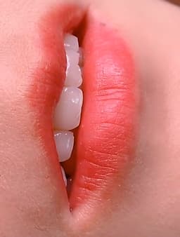 TMV Dowha -  Phun Môi Tế Bào Gốc