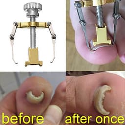 Dụng Cụ Bẻ Móng Quặp Thịt