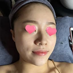 Combo phun noãn thực vật giúp làn da đều màu, se khít lỗ chân lông tại Dory Beauty Spa
