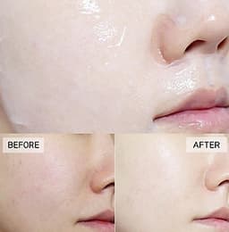Combo 10 Mặt nạ BNBG Vita Genic Jelly Mask 30ml x10 (Lifting, Whitening, Relaxing, Hydrating)