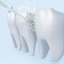 Máy tăm nước Xiaomi Mijia Flosser - Bình xịt vệ sinh răng miệng Xiaomi Mijia Flosser